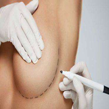 Chirurgie plastique pour augmentation mammaire