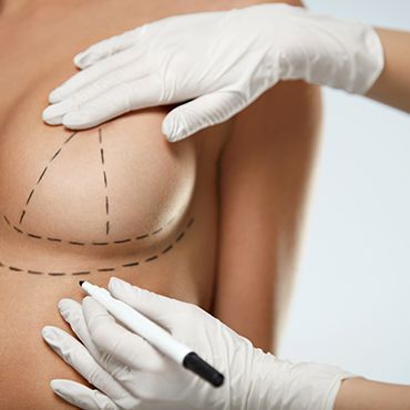 Операции по коррекции формы груди